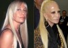 Seven Plastic Surgeries gone wrong, #7 is the worst case you will ever see plastic-surgery-fact-8w
