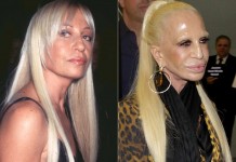 Seven Plastic Surgeries gone wrong, #7 is the worst case you will ever see plastic-surgery-fact-8w