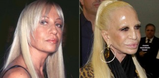 Seven Plastic Surgeries gone wrong, #7 is the worst case you will ever see plastic-surgery-fact-8w