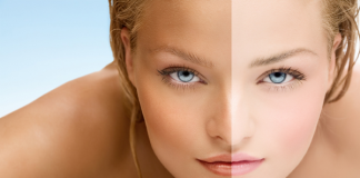 Removing sun tan naturally at home- 5 most effective Ways.