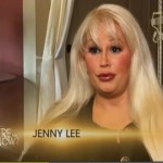plastic-surgery-before-and-after-145
