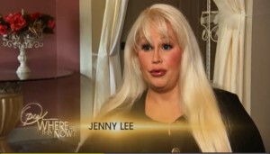 plastic-surgery-before-and-after-145