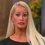 plastic-surgery-before-and-after-145