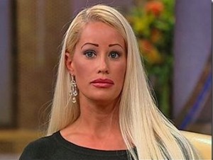 plastic-surgery-before-and-after-145