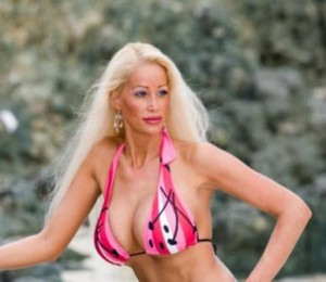 plastic-surgery-before-and-after-145