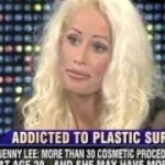 plastic-surgery-before-and-after-145