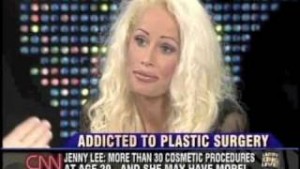 plastic-surgery-before-and-after-145