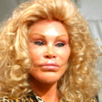 plastic-surgery-gone-wrong-1-78