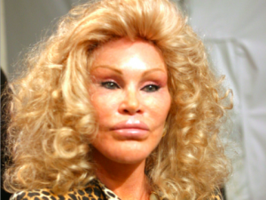 plastic-surgery-gone-wrong-1-78