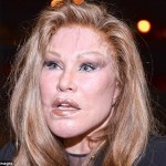 plastic-surgery-gone-wrong-1-78
