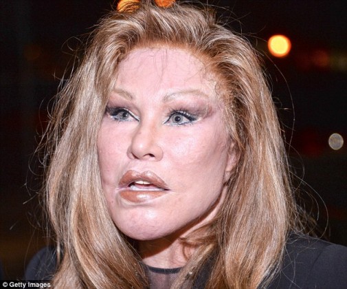 plastic-surgery-gone-wrong-1-78