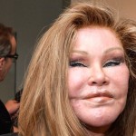 plastic-surgery-gone-wrong-1-78