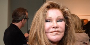 plastic-surgery-gone-wrong-1-78