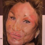 plastic-surgery-gone-wrong-1-78