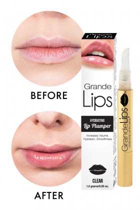 elle lipinjection beforeafter grandelips for attractive lips