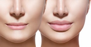 lip enhancer for attractive lips